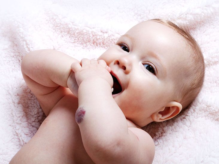 Uşağın gözündəki nadir hemangioma əməliyyatı